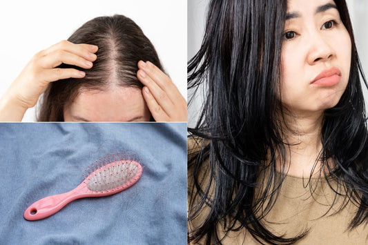 Is Stress or Hormonal Change Behind Your Hair Fall? Find Out Here!